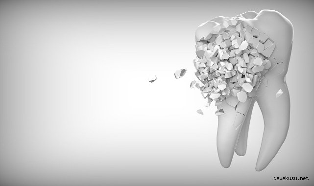 Diş tedavisinde yeni yöntem: Devekuşu yumurtası